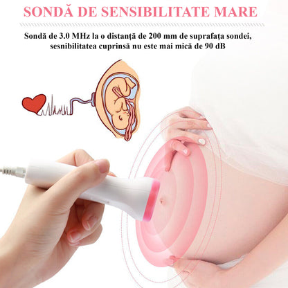 Monitor fetal Doppler, Invincio, pentru monitorizare functii vitale fat intrauterin, gel ultrasunete inclus, Zero radiatii, detectarea batailor inimii/pulsului fatului, pentru gravide, portabil, alb/roz